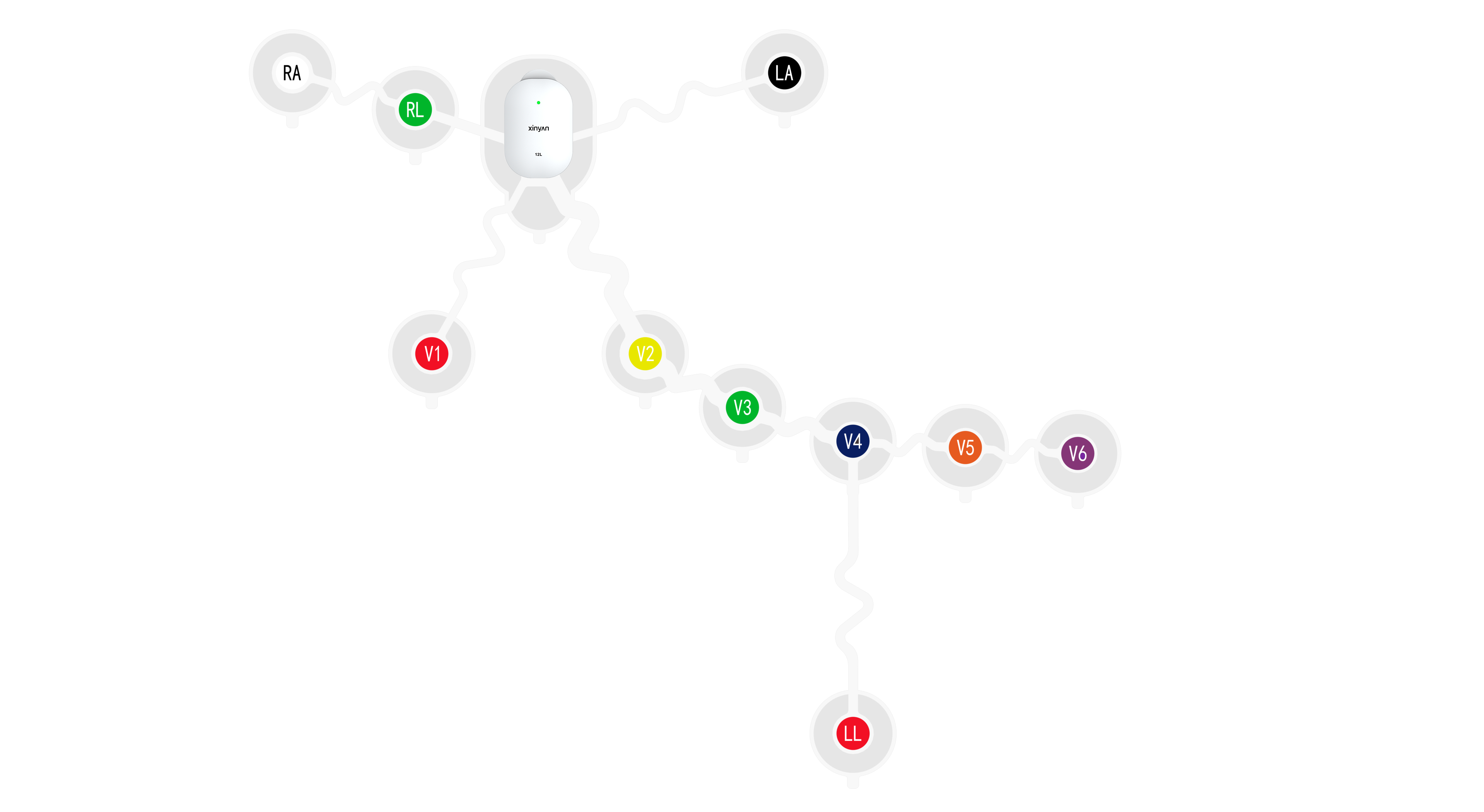 12导穿戴式动态心电监护系统